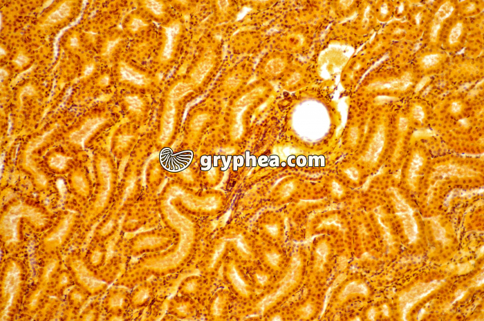 Tubules Rein x40 - gryphea.com